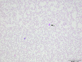 Monolayer (DQ)