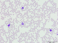 Neutrophil & lymphocyte (DQ)