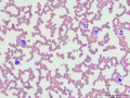Neutrophil, lymphocyte & monocyte (DQ)