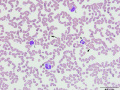 Neutrophil, lymphocyte & monocyte (DQ)