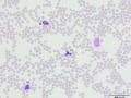 Neutrophil & lymphocyte (DQ)