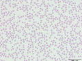 Erythrocytes (DQ)
