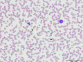 Neutrophil & lymphocyte (DQ)