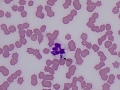 Degrading Anaplasma