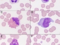Normal cell compilation