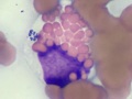Anaplasma phagocytophilum (eosinophil)