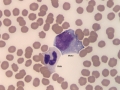 Neutrophil & monocyte
