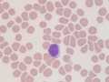 Lymphocyte