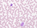 Neutrophil & monocyte