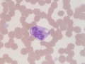 Monocyte