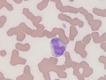 Monocyte