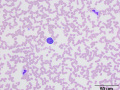 Reactive lymphocyte