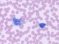 Monocyte & lymphocyte