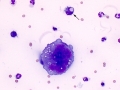 Mesothelial cell