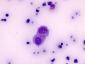 Mesothelial cells