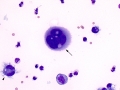 Mesothelial cell