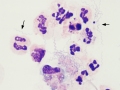 Borrelia