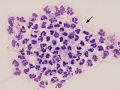 Borrelia