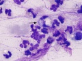 Brucella