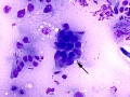 Basilar corneal epithelium