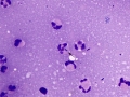 Corneal infection (horse)