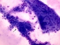 Superficial and deep corneal epithelium