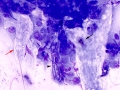 Aspergillus (horse cornea)