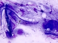 Aspergillus (horse cornea)