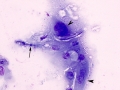 Aspergillus (horse cornea)
