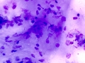 Superficial corneal epithelium