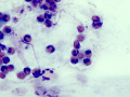 Eosinophilic conjunctivitis (bovine)