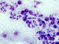 Eosinophilic conjunctivitis (bovine)