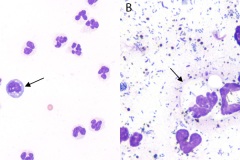 Cytology features