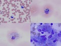 Bad things in phagocytes
