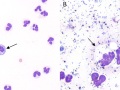 Degenerate and non-degenerate neutrophils