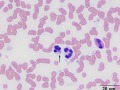 Anaplasma phagocytophilum
