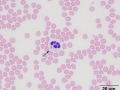 Anaplasma phagocytophilum