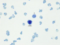 Heinz bodies, nRBC & aggregate reticulocyte (NMB)