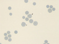 Punctate reticulocytes (NMB)