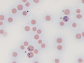 Aggregate & punctate reticulocyte (NMB & Wright