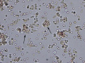 IMHA (wet prep)