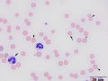 Mycoplasma haemofelis