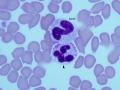 Neutrophil with mast cell granules