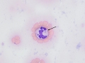 Anaplasma phagocytophilum
