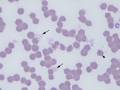 Mycoplasma & Cytauxzoon