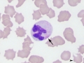 Birman granulation