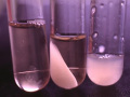 Cryoglobulin
