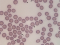 Cytauxzoon