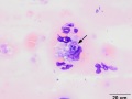 Histiocytes (leukophagocytic)