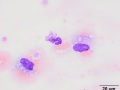 Histiocytes